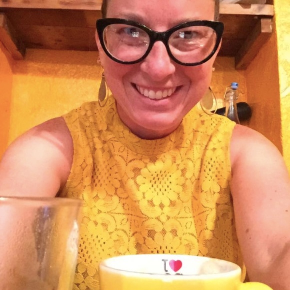 Forever 21 Mustard Lace Dress - Picture 6 of 7